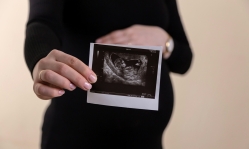 Dutch Christians push back on plan to expand late-term abortions for 'social reasons'