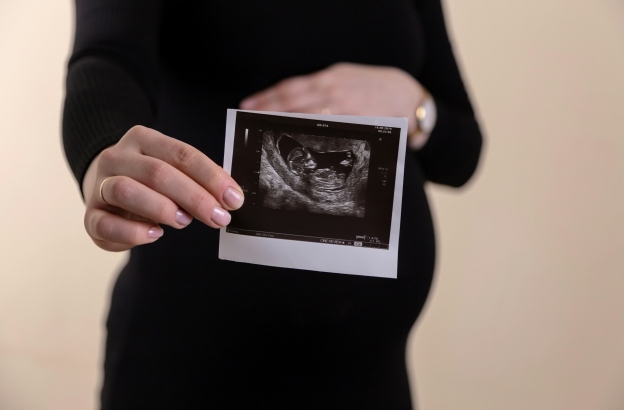 Dutch Christians push back on plan to expand late-term abortions for 'social reasons'
