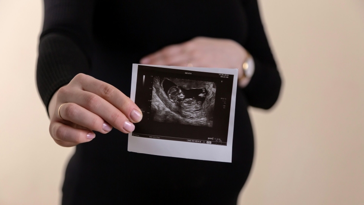 Dutch Christians push back on plan to expand late-term abortions for 'social reasons'